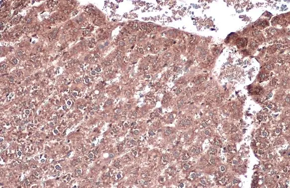 Vinculin antibody [GT3210] detects Vinculin protein at cytoplasm by immunohistochemical analysis. Sample: Paraffin-embedded rat liver. Vinculin stained by Vinculin antibody [GT3210] (GTX634535) diluted at 1:200. Antigen Retrieval: Citrate buffer, pH 6.0, 15 min