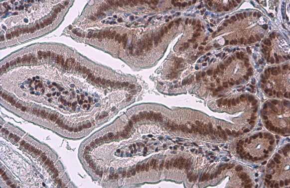 Anti-Glucocorticoid Receptor antibody [GT248] (GTX634647