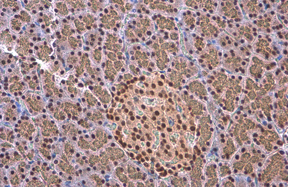 EED antibody [GT885] detects EED protein at cytoplasm and nucleus by immunohistochemical analysis. Sample: Paraffin-embedded rat endometrial carcinoma. EED stained by EED antibody [GT885] (GTX634650) diluted at 1:200. Antigen Retrieval: Citrate buffer, pH 6.0, 15 min
