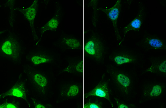 EED antibody [GT885] detects EED protein at nucleus by immunofluorescent analysis. Sample: HeLa cells were fixed in 4% paraformaldehyde at RT for 15 min. Green: EED stained by EED antibody [GT885] (GTX634650) diluted at 1:1000. Blue: Hoechst 33342 staining.