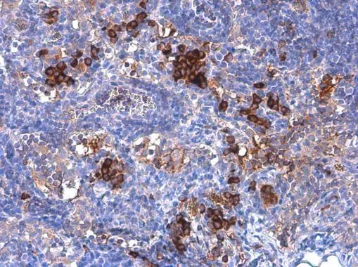 IDO1 antibody [GT273]
