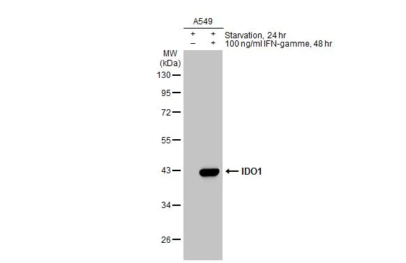 Untreated (–) and treated (+) A549 whole cell extracts (30 μg) were separated by 10% SDS-PAGE, and the membrane was blotted with IDO1 antibody [GT273] (GTX634652) diluted at 1:5000. The HRP-conjugated anti-mouse IgG antibody (GTX213111-01) was used to detect the primary antibody.