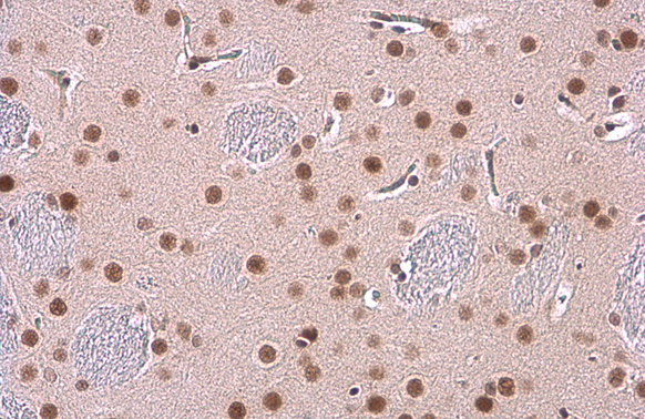 Glucocorticoid Receptor antibody [GT1073] detects Glucocorticoid Receptor protein at nucleus by immunohistochemical analysis. Sample: Paraffin-embedded rat brain. Glucocorticoid Receptor stained by Glucocorticoid Receptor antibody [GT1073] (GTX634705) diluted at 1:1000. Antigen Retrieval: Citrate buffer, pH 6.0, 15 min