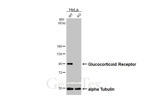 Wild-type (WT) and NR3C1 knockout (KO) HeLa cell extracts (30 μg) were separated by 7.5% SDS-PAGE, and the membrane was blotted with Glucocorticoid Receptor antibody [GT1073] (GTX634705) diluted at 1:1000. The HRP-conjugated anti-mouse IgG antibody (GTX213111-01) was used to detect the primary antibody.