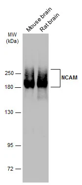NCAM antibody [GT135]