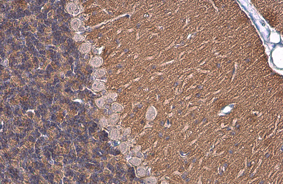 NCAM antibody [GT135]
