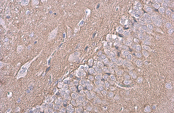 NCAM antibody [GT135]