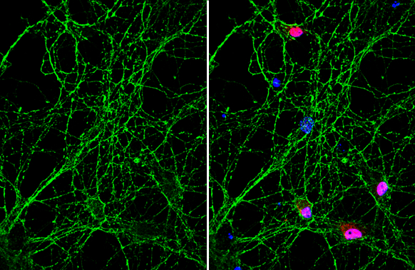 NCAM antibody [GT135]
