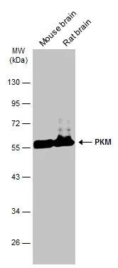 PKM antibody [GT1810]