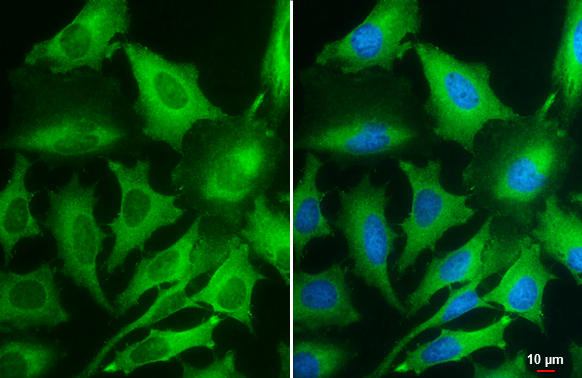 PKM antibody [GT1810]