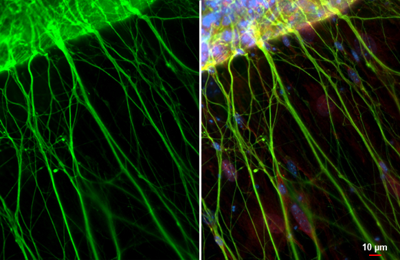 PGP9.5 antibody [GT448] detects PGP9.5 protein at cytoplasm by immunofluorescent analysis. Sample: mouse dorsal root ganglia cells were fixed in 4% paraformaldehyde at RT for 15 min. Green: PGP9.5 stained by PGP9.5 antibody [GT448] (GTX634797) diluted at 1:500. Red: NeuN, a neuronal nuclei marker, stained by NeuN antibody [HL2194] (GTX638198) diluted at 1:500. Blue: Fluoroshield with DAPI (GTX30920).