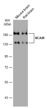 NCAM antibody [GT249]