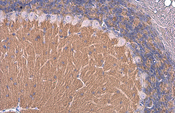 NCAM antibody [GT249]