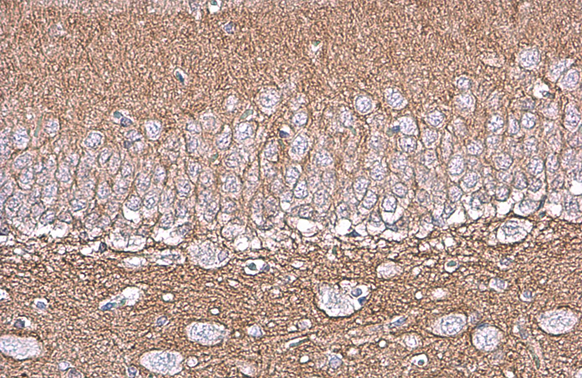NCAM antibody [GT249]
