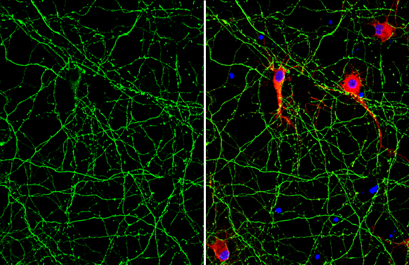 Tau antibody [GT287]