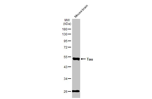 Tau antibody [GT287]
