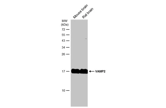Various tissue extracts (50 μg) were separated by 15% SDS-PAGE, and the membrane was blotted with VAMP2 [GT6311] (GTX634812) diluted at 1:1000. The HRP-conjugated anti-mouse IgG antibody (GTX213111-01) was used to detect the primary antibody.