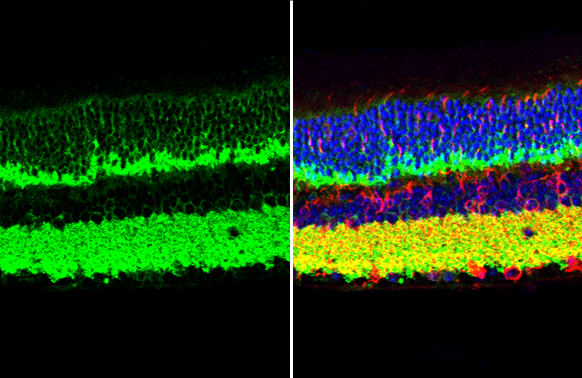 VAMP2 antibody [GT6311] detects VAMP2 protein at cell membrane and cytoplasm by immunohistochemical analysis. Sample: Paraffin-embedded mouse eye. Green: VAMP2 stained by VAMP2 antibody [GT6311] (GTX634812) diluted at 1:500. Red: beta Tubulin 3/ Tuj1, a cytoskeleton marker, stained by beta Tubulin 3/ Tuj1 antibody (GTX130245) diluted at 1:250. Blue: Fluoroshield with DAPI (GTX30920). Antigen Retrieval: Citrate buffer, pH 6.0, 15 min