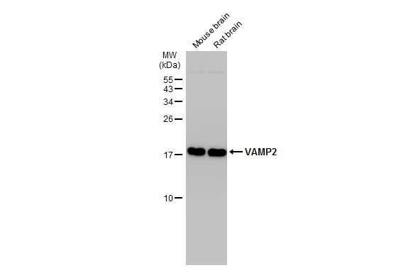 Various tissue extracts (50 μg) were separated by 15% SDS-PAGE, and the membrane was blotted with VAMP2 antibody [GT766] (GTX634829) diluted at 1:1000. The HRP-conjugated anti-mouse IgG antibody (GTX213111-01) was used to detect the primary antibody.