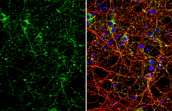 VAMP2 antibody [GT766] detects VAMP2 protein by immunofluorescent analysis. Sample: DIV10 rat E18 primary cortical neuron cells were fixed in 4% paraformaldehyde at RT for 15 min. Green: VAMP2 stained by VAMP2 antibody [GT766] (GTX634829) diluted at 1:500. Red: Tau, stained by Tau antibody (GTX130462) diluted at 1:500. Blue: Fluoroshield with DAPI (GTX30920).