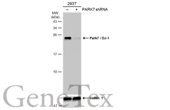 293T whole cell extracts (30 μg) were separated by 15% SDS-PAGE, and the membrane was blotted with Park7 / DJ-1 antibody [GT136] (GTX634831) diluted at 1:10000. The HRP-conjugated anti-mouse IgG antibody (GTX213111-01) was used to detect the primary antibody.