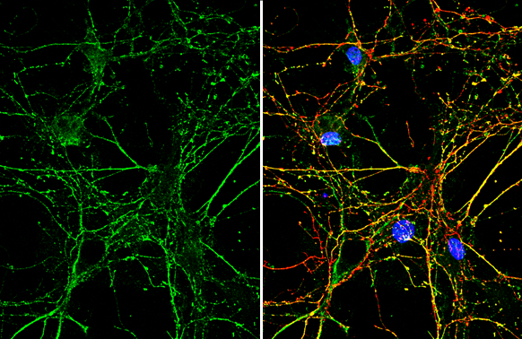 Park7 / DJ-1 antibody [GT136] detects Park7 / DJ-1 protein by immunofluorescent analysis. Sample: DIV9 rat E18 primary hippocampal neuron cells were fixed in 4% paraformaldehyde at RT for 15 min. Green: Park7 / DJ-1 stained by Park7 / DJ-1 antibody [GT136] (GTX634831) diluted at 1:500. Red: Tau, stained by Tau antibody (GTX112981) diluted at 1:500. Blue: Fluoroshield with DAPI (GTX30920).