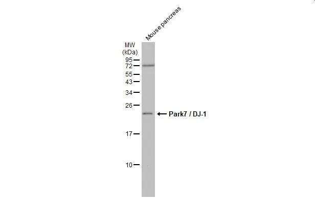 Mouse tissue extract (50 μg) was separated by 15% SDS-PAGE, and the membrane was blotted with Park7 / DJ-1 antibody [GT136] (GTX634831) diluted at 1:1000. The HRP-conjugated anti-mouse IgG antibody (GTX213111-01) was used to detect the primary antibody, and the signal was developed with Trident ECL plus-Enhanced.