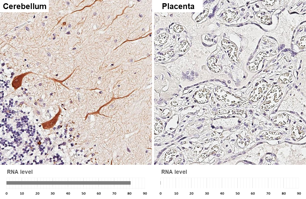 Anti-Calbindin antibody [GT386] (GTX634833) | GeneTex