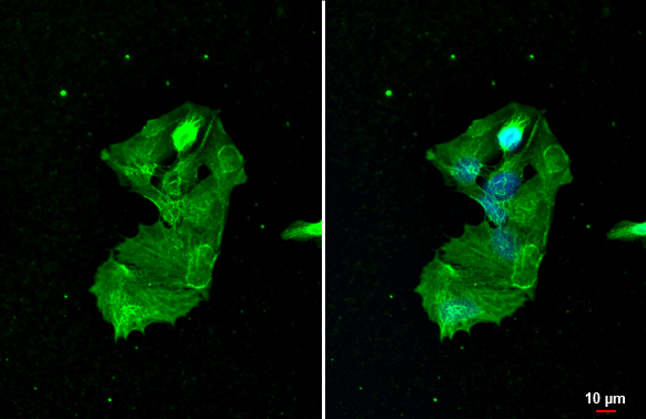 Anti-Cytokeratin 19 antibody [GT147] (GTX635163) | GeneTex