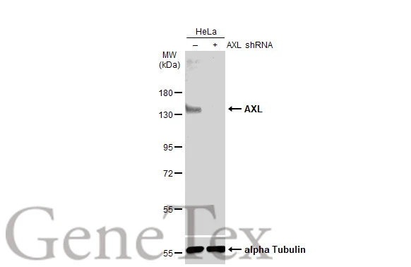 AXL antibody [GT1174]