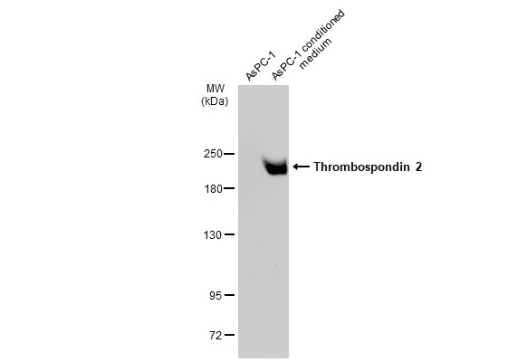 Thrombospondin 2 antibody [GT147]