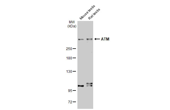 Various tissue extracts (50 μg) were separated by 5% SDS-PAGE, and the membrane was blotted with ATM antibody [2C1-RB] (GTX635395) diluted at 1:1000. The HRP-conjugated anti-rabbit IgG antibody (GTX213110-01) was used to detect the primary antibody.