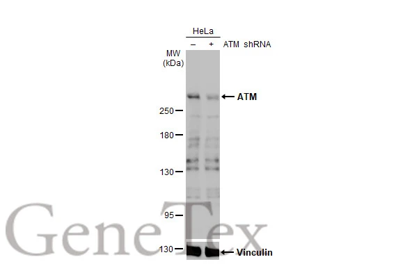 Non-transfected (–) and transfected (+) HeLa whole cell extracts (30 μg) were separated by 5% SDS-PAGE, and the membrane was blotted with ATM antibody [2C1-RB] (GTX635395) diluted at 1:1000. The HRP-conjugated anti-rabbit IgG antibody (GTX213110-01) was used to detect the primary antibody.