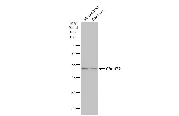 Various tissue extracts (50 μg) were separated by 10% SDS-PAGE, and the membrane was blotted with C9orf72 antibody [GT779-RB] (GTX635397) diluted at 1:500. The HRP-conjugated anti-rabbit IgG antibody (GTX213110-01) was used to detect the primary antibody.