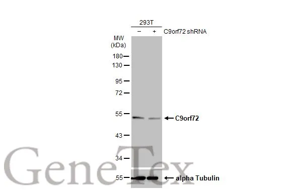 Non-transfected (–) and transfected (+) 293T whole cell extracts (30 μg) were separated by 10% SDS-PAGE, and the membrane was blotted with C9orf72 antibody [GT779-RB] (GTX635397) diluted at 1:500. The HRP-conjugated anti-rabbit IgG antibody (GTX213110-01) was used to detect the primary antibody.