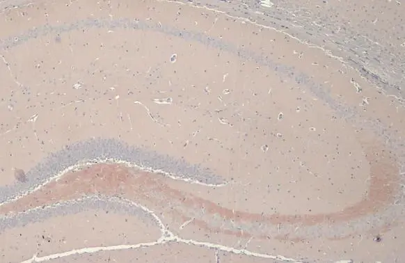 C9orf72 antibody [GT779-RB] detects C9orf72 protein at cytoplasm by immunohistochemical analysis. Sample: Paraffin-embedded mouse brain. C9orf72 stained by C9orf72 antibody [GT779-RB] (GTX635397) diluted at 1:100. Antigen Retrieval: Citrate buffer, pH 6.0, 15 min