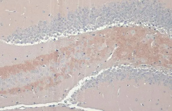 C9orf72 antibody [GT779-RB] detects C9orf72 protein at cytoplasm by immunohistochemical analysis. Sample: Paraffin-embedded mouse brain. C9orf72 stained by C9orf72 antibody [GT779-RB] (GTX635397) diluted at 1:100. Antigen Retrieval: Citrate buffer, pH 6.0, 15 min
