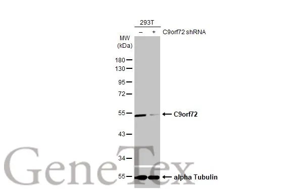 Non-transfected (–) and transfected (+) 293T whole cell extracts (30 μg) were separated by 7.5% SDS-PAGE, and the membrane was blotted with C9orf72 antibody [GT1553-RB] (GTX635398) diluted at 1:500. The HRP-conjugated anti-rabbit IgG antibody (GTX213110-01) was used to detect the primary antibody.