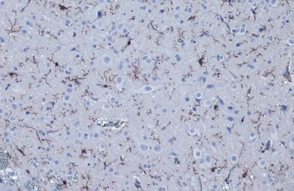 Anti-Iba1 antibody [HL22-MS] (GTX635399) | GeneTex