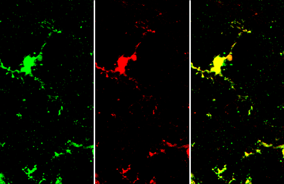 Iba1 antibody [HL22-RT] detects Iba1 protein by immunohistochemical analysis. Sample: Frozen-sectioned mouse brain. Green: Iba1 stained by Iba1 antibody [HL22] (GTX635363) diluted at 1:100. Red: Iba1 stained by Iba1 antibody [HL22-RT] (GTX635400) diluted at 1:100. Blue: Fluoroshield with DAPI (GTX30920).