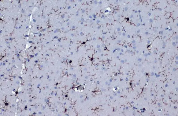 Iba1 antibody [HL22-RT] detects Iba1 protein at cell membrane and cytoplasm by immunohistochemical analysis. Sample: Paraffin-embedded rat brain. Iba1 stained by Iba1 antibody [HL22-RT] (GTX635400) diluted at 1:500. Antigen Retrieval: Citrate buffer, pH 6.0, 15 min