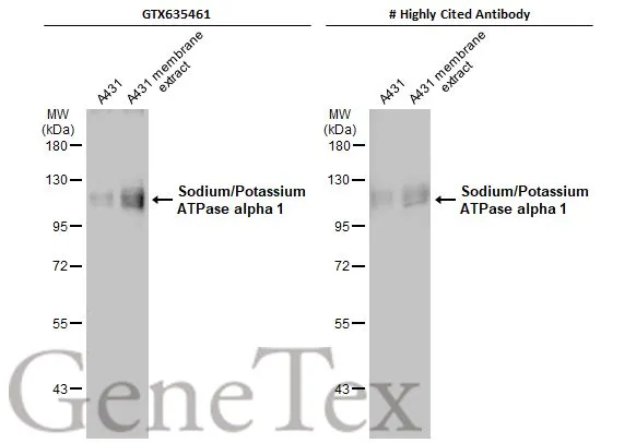 Anti-Sodium/Potassium ATPase alpha 1 antibody [HL114