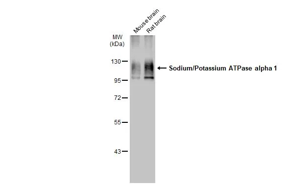 Anti-Sodium/Potassium ATPase alpha 1 antibody [HL114