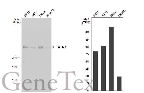 Various whole cell extracts (30 μg) were separated by 5% SDS-PAGE, and the membrane was blotted with ATRX antibody [HL1210] (GTX635478) diluted at 1:1000. The HRP-conjugated anti-rabbit IgG antibody (GTX213110-01) was used to detect the primary antibody. Corresponding RNA expression data for the same cell lines are based on Human Protein Atlas program.