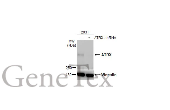 Non-transfected (–) and transfected (+) 293T whole cell extracts (30 μg) were separated by 5% SDS-PAGE, and the membrane was blotted with ATRX antibody [HL1210] (GTX635478) diluted at 1:500. The HRP-conjugated anti-rabbit IgG antibody (GTX213110-01) was used to detect the primary antibody, and the signal was developed with Trident ECL plus-Enhanced.