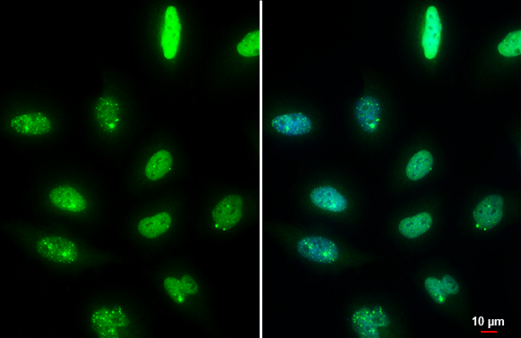 53BP1 antibody [HL275] detects 53BP1 protein at nucleus by immunofluorescent analysis.</br>Sample: HeLa cells were fixed in 4% paraformaldehyde at RT for 15 min.</br>Green: 53BP1 stained by 53BP1 antibody [HL275] (GTX635479) diluted at 1:1000.</br>Blue: Fluoroshield with DAPI (GTX30920).</br>Scale bar= 10 μm.