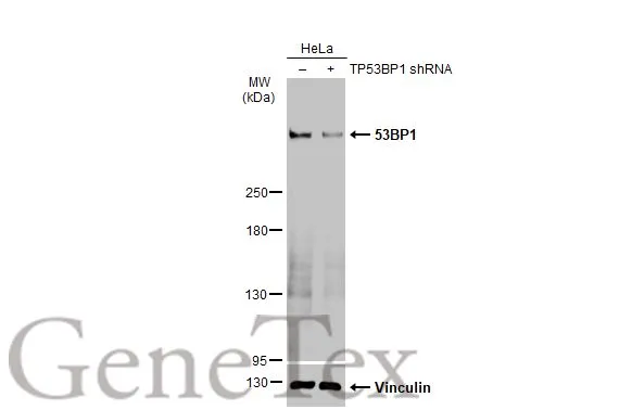 Non-transfected (–) and transfected (+) HeLa whole cell extracts (30 μg) were separated by 5% SDS-PAGE, and the membrane was blotted with 53BP1 antibody [HL36] (GTX635479) diluted at 1:1000. The HRP-conjugated anti-rabbit IgG antibody (GTX213110-01) was used to detect the primary antibody.
