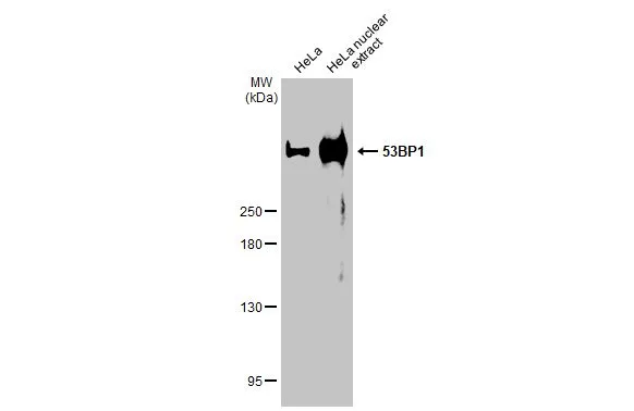 HeLa whole cell and nuclear extracts (30 μg) were separated by 5% SDS-PAGE, and the membrane was blotted with 53BP1 antibody [HL36] (GTX635479) diluted at 1:1000. The HRP-conjugated anti-rabbit IgG antibody (GTX213110-01) was used to detect the primary antibody.