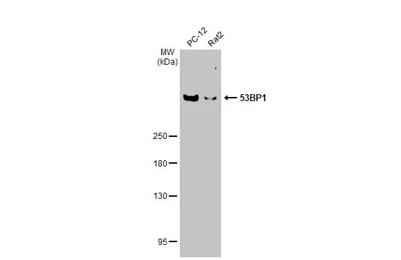 Various whole cell extracts (30 μg) were separated by 5% SDS-PAGE, and the membrane was blotted with 53BP1 antibody [HL36] (GTX635479) diluted at 1:1000. The HRP-conjugated anti-rabbit IgG antibody (GTX213110-01) was used to detect the primary antibody.