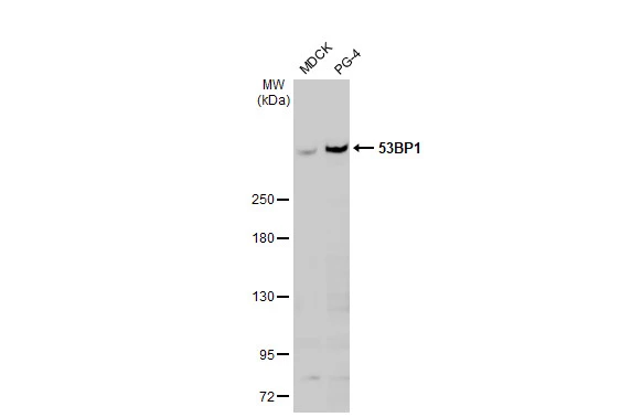 Various whole cell extracts (30 μg) were separated by 5% SDS-PAGE, and the membrane was blotted with 53BP1 antibody [HL36] (GTX635479) diluted at 1:1000. The HRP-conjugated anti-rabbit IgG antibody (GTX213110-01) was used to detect the primary antibody.